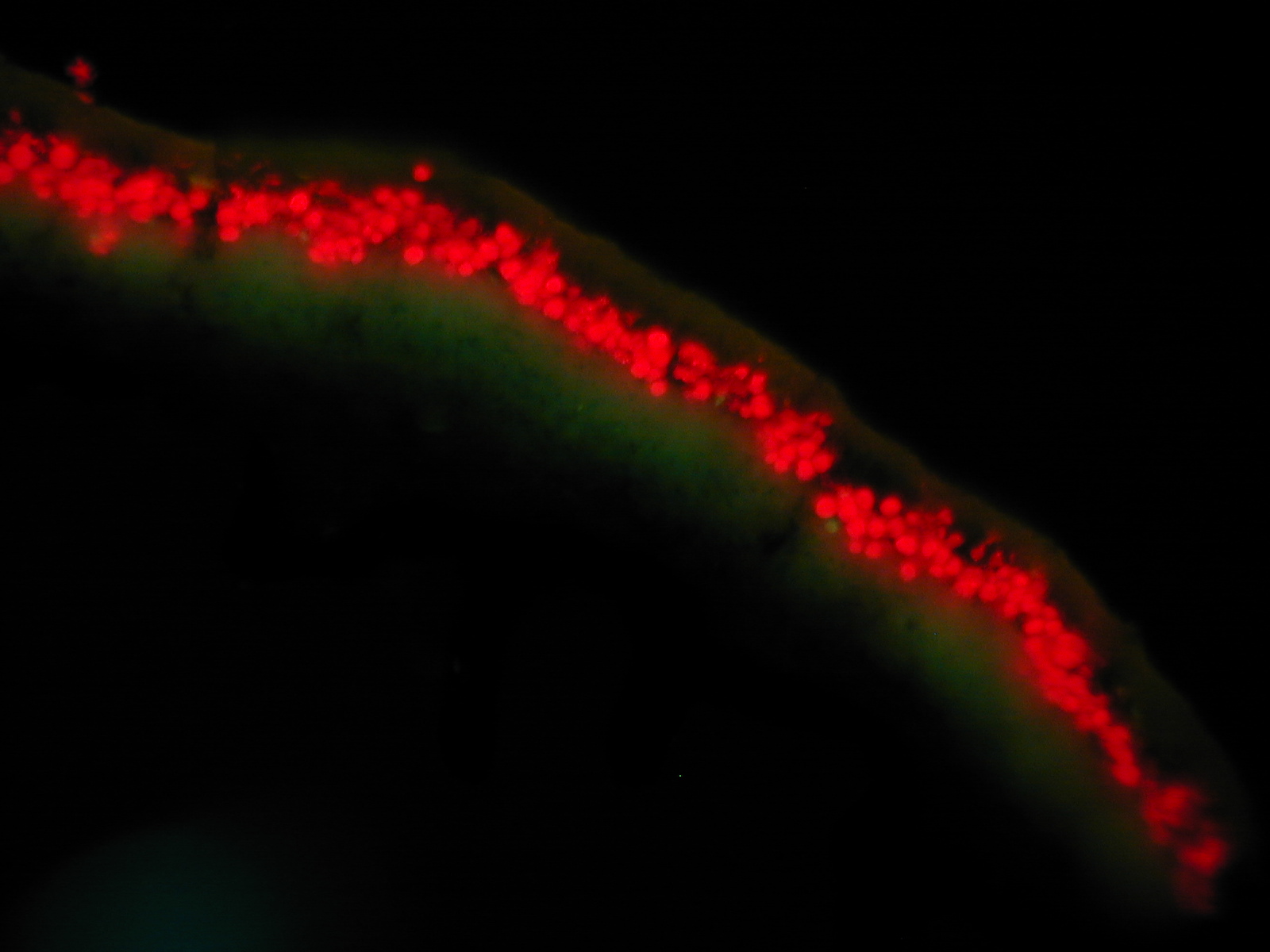 Monte Amiata mt. 1700 - Parmelina pastillifera